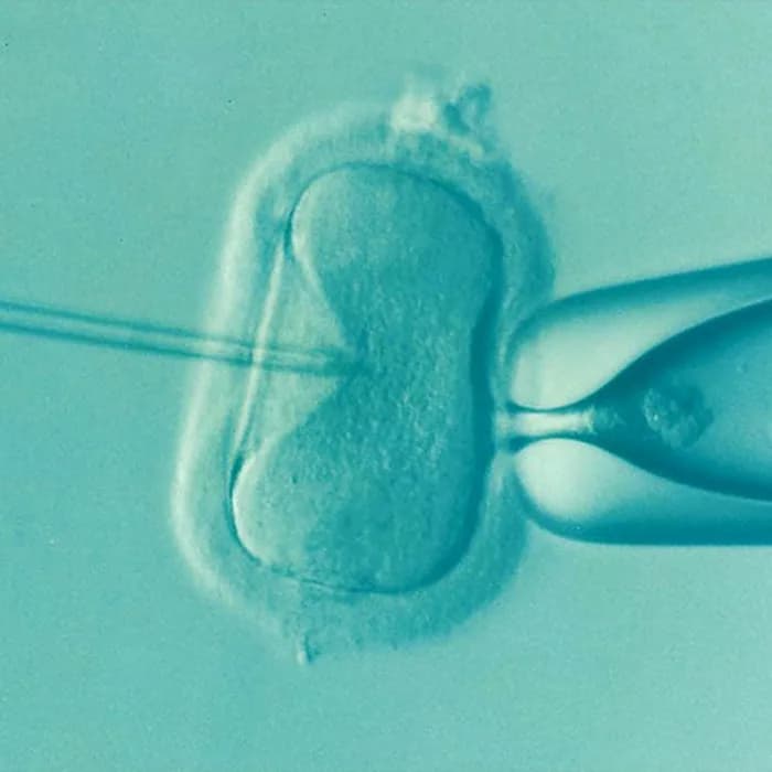 Microscope view, tinted blue-green, of an egg cell held by a pipette during intracytoplasmic sperm injection